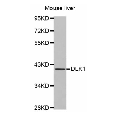 Western blot - DLK1 antibody from Signalway Antibody (38446) - Antibodies.com