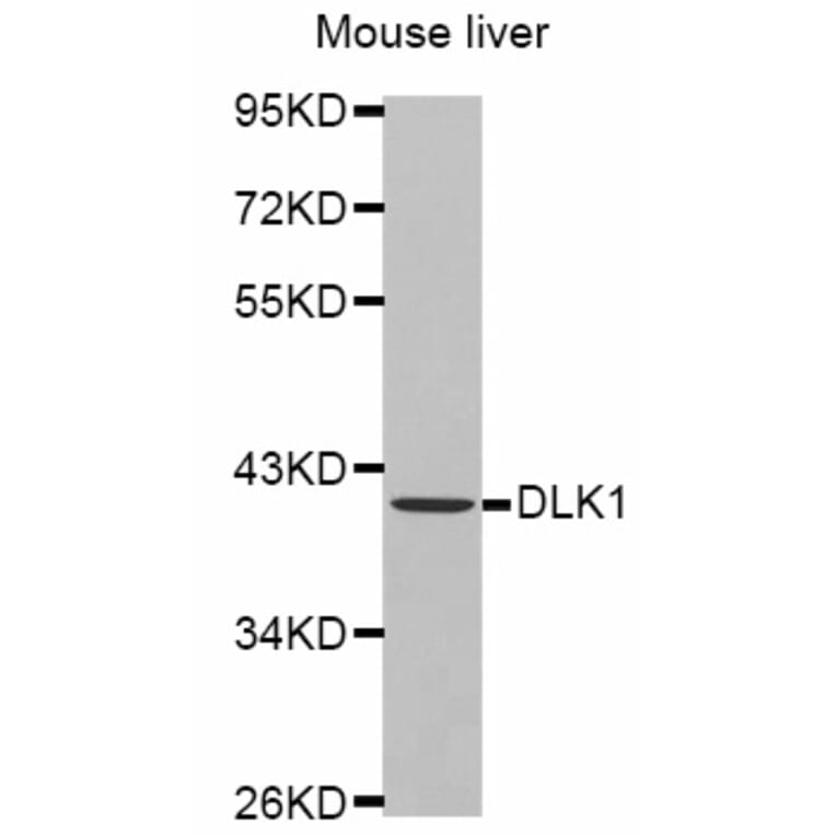 Western blot - DLK1 antibody from Signalway Antibody (38446) - Antibodies.com