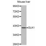 Western blot - DLK1 antibody from Signalway Antibody (38446) - Antibodies.com