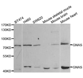 Western blot - GNAS antibody from Signalway Antibody (38452) - Antibodies.com