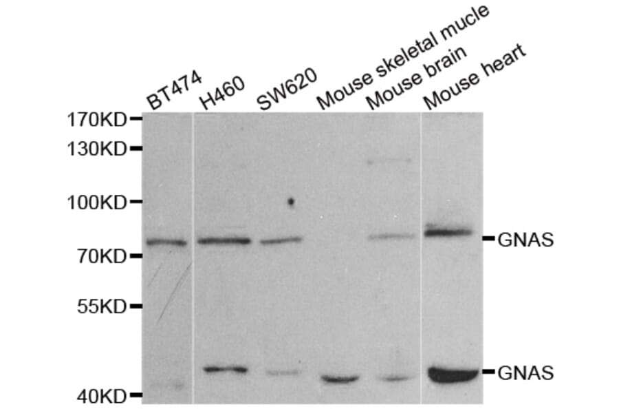Western blot - GNAS antibody from Signalway Antibody (38452) - Antibodies.com