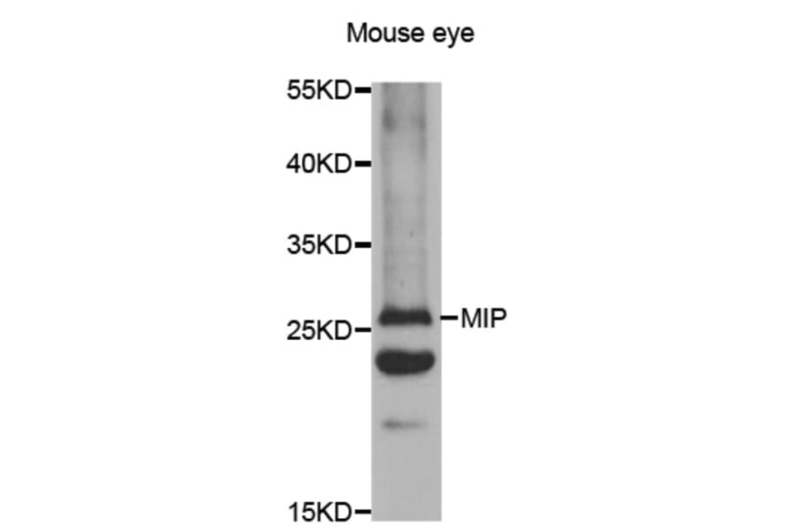 Western blot - AQP0 antibody from Signalway Antibody (38479) - Antibodies.com