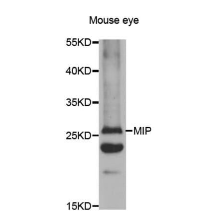 Western blot - AQP0 antibody from Signalway Antibody (38479) - Antibodies.com