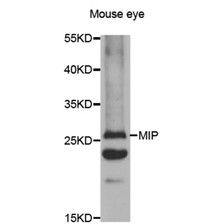 Western blot - AQP0 antibody from Signalway Antibody (38479) - Antibodies.com