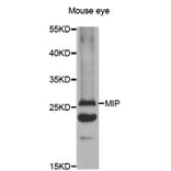 Western blot - AQP0 antibody from Signalway Antibody (38479) - Antibodies.com