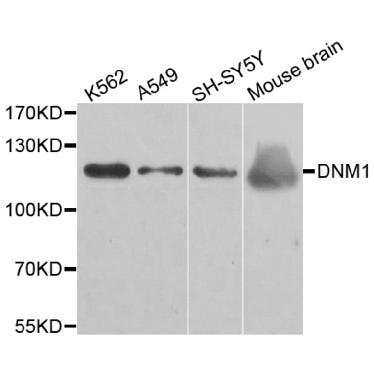 Western blot - DNM1 antibody from Signalway Antibody (38490) - Antibodies.com