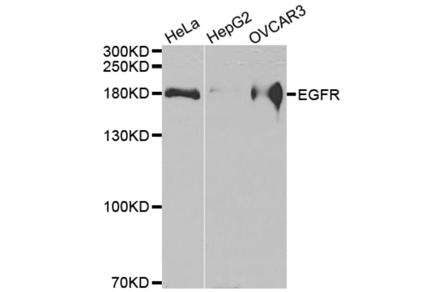 Western blot - EGFR antibody from Signalway Antibody (38493) - Antibodies.com