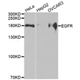 Western blot - EGFR antibody from Signalway Antibody (38493) - Antibodies.com