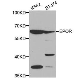 Western blot - EPOR antibody from Signalway Antibody (38497) - Antibodies.com
