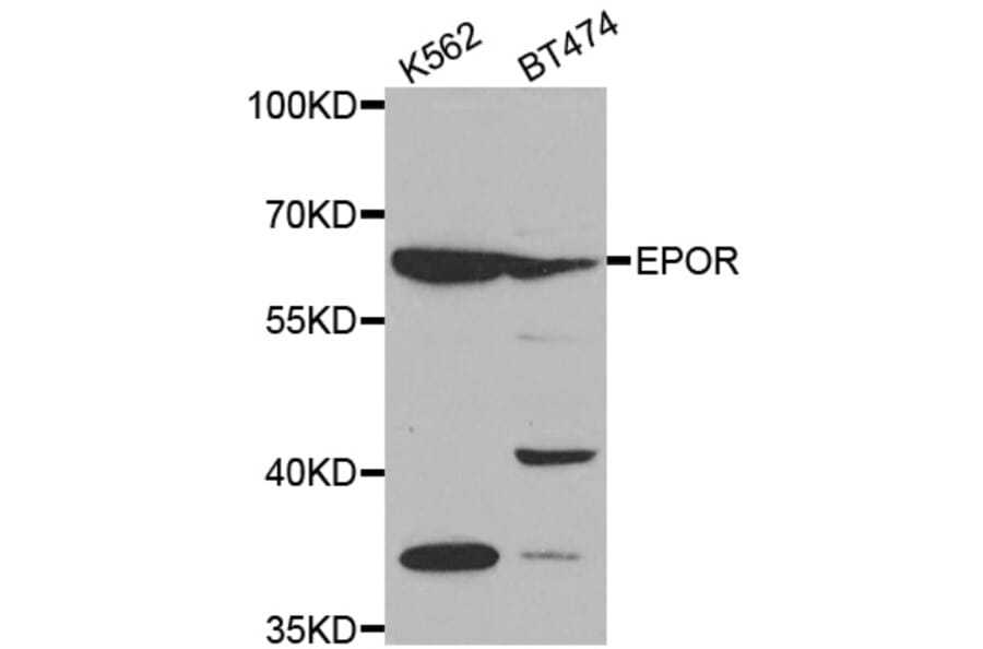 Western blot - EPOR antibody from Signalway Antibody (38497) - Antibodies.com