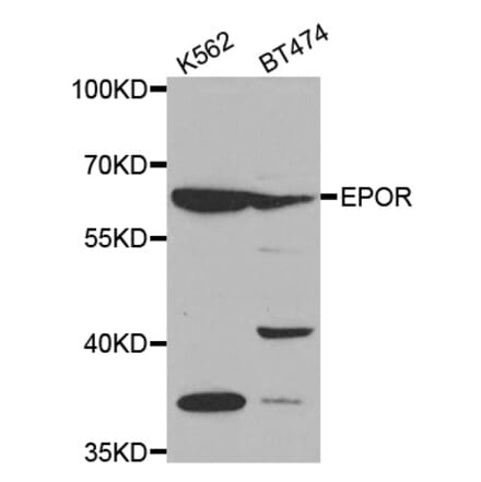 Western blot - EPOR antibody from Signalway Antibody (38497) - Antibodies.com