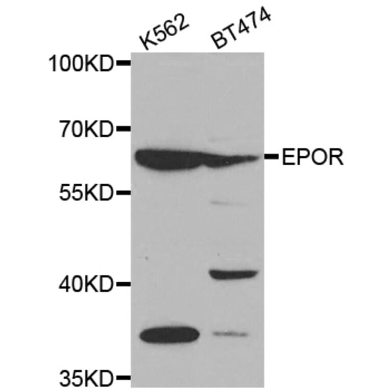 Western blot - EPOR antibody from Signalway Antibody (38497) - Antibodies.com