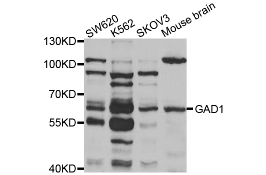 Western blot - GAD1 antibody from Signalway Antibody (38501) - Antibodies.com