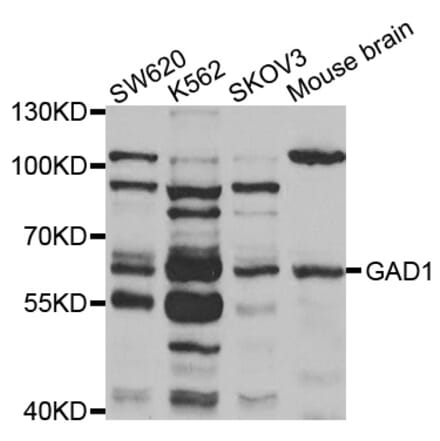 Western blot - GAD1 antibody from Signalway Antibody (38501) - Antibodies.com