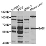 Western blot - GAD1 antibody from Signalway Antibody (38501) - Antibodies.com