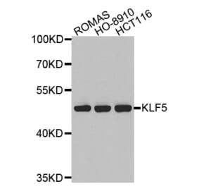 Western blot - KLF5 antibody from Signalway Antibody (38526) - Antibodies.com