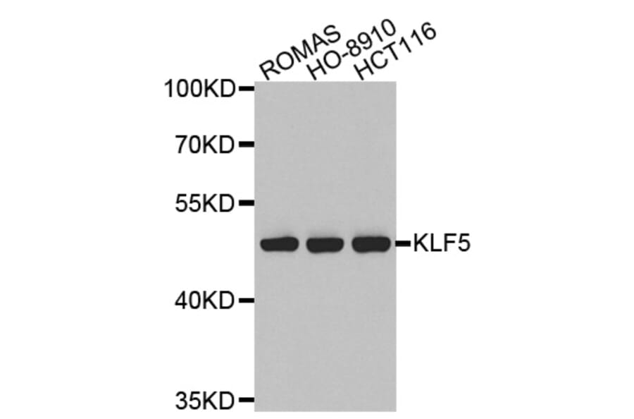 Western blot - KLF5 antibody from Signalway Antibody (38526) - Antibodies.com