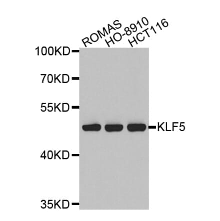 Western blot - KLF5 antibody from Signalway Antibody (38526) - Antibodies.com
