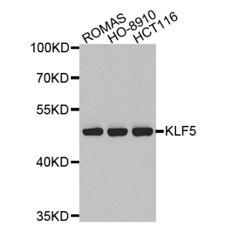 Western blot - KLF5 antibody from Signalway Antibody (38526) - Antibodies.com