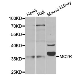Western blot - MC2R antibody from Signalway Antibody (38534) - Antibodies.com