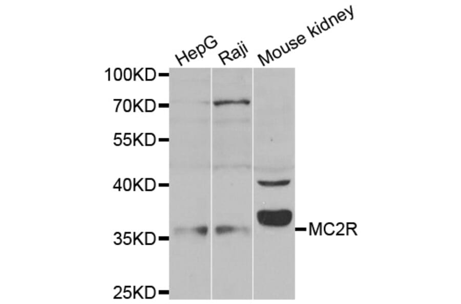 Western blot - MC2R antibody from Signalway Antibody (38534) - Antibodies.com