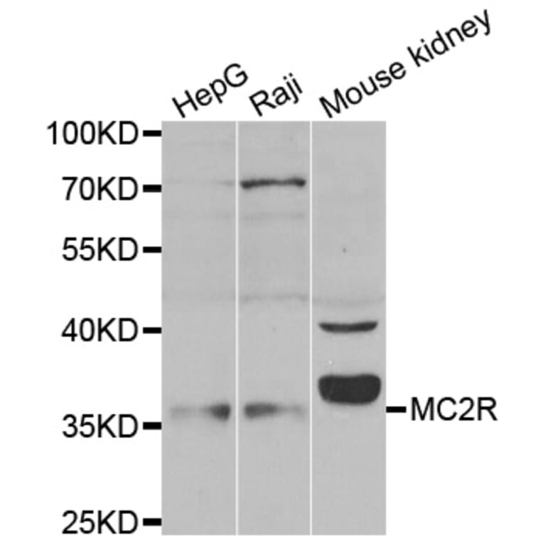 Western blot - MC2R antibody from Signalway Antibody (38534) - Antibodies.com