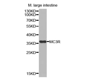 Western blot - MC3R antibody from Signalway Antibody (38535) - Antibodies.com