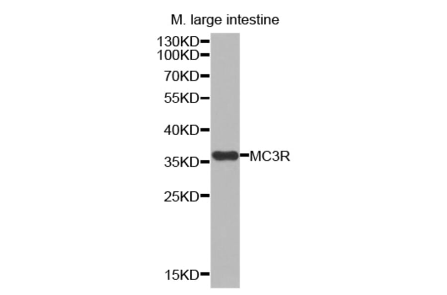 Western blot - MC3R antibody from Signalway Antibody (38535) - Antibodies.com