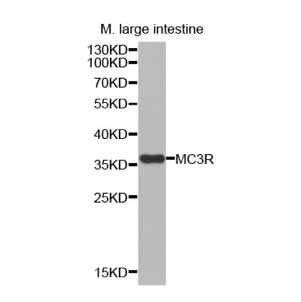 Western blot - MC3R antibody from Signalway Antibody (38535) - Antibodies.com