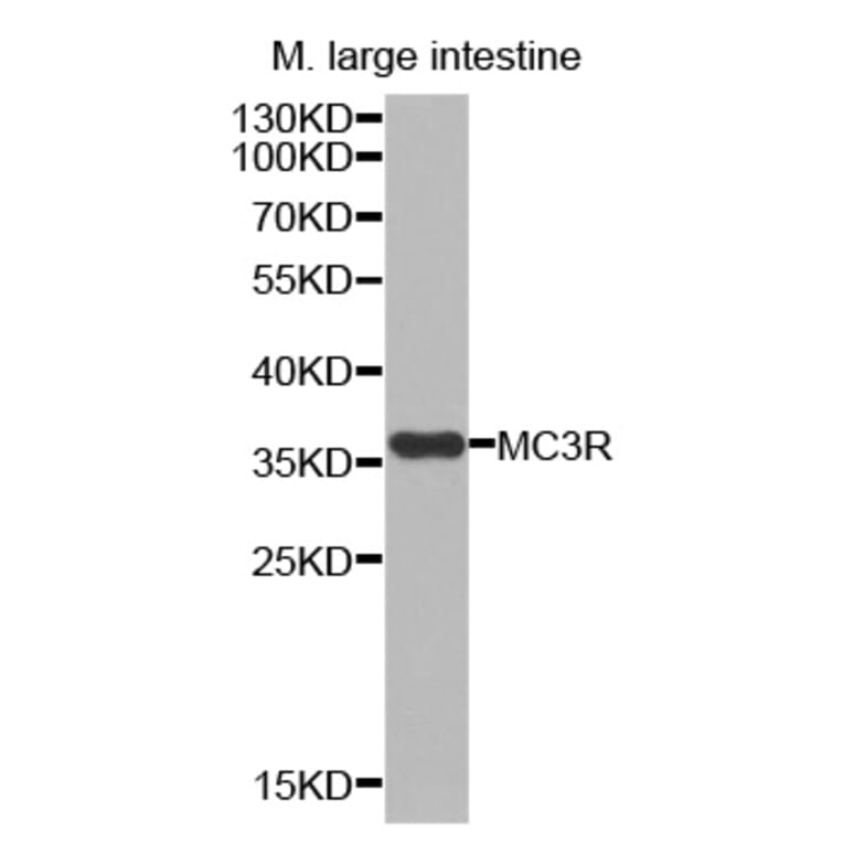 Western blot - MC3R antibody from Signalway Antibody (38535) - Antibodies.com