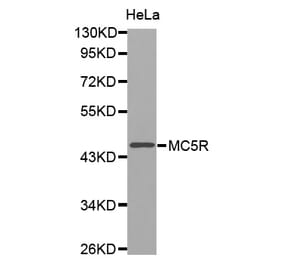 Western blot - MC5R antibody from Signalway Antibody (38536) - Antibodies.com