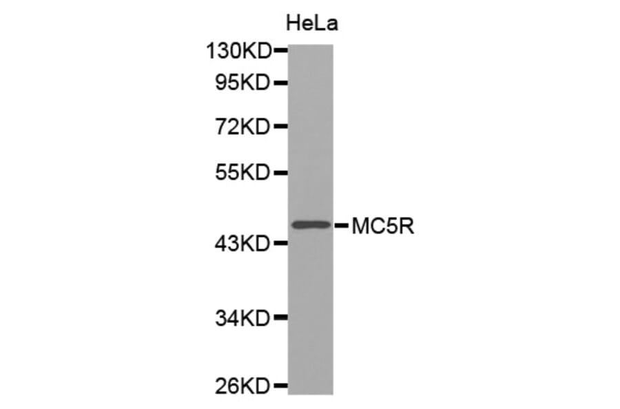Western blot - MC5R antibody from Signalway Antibody (38536) - Antibodies.com