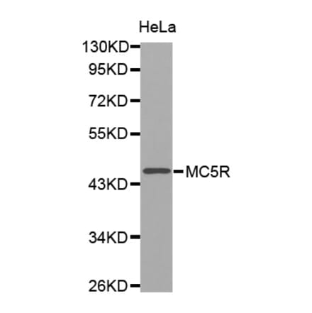 Western blot - MC5R antibody from Signalway Antibody (38536) - Antibodies.com