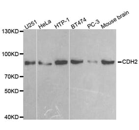 Western blot - CDH2 antibody from Signalway Antibody (38551) - Antibodies.com