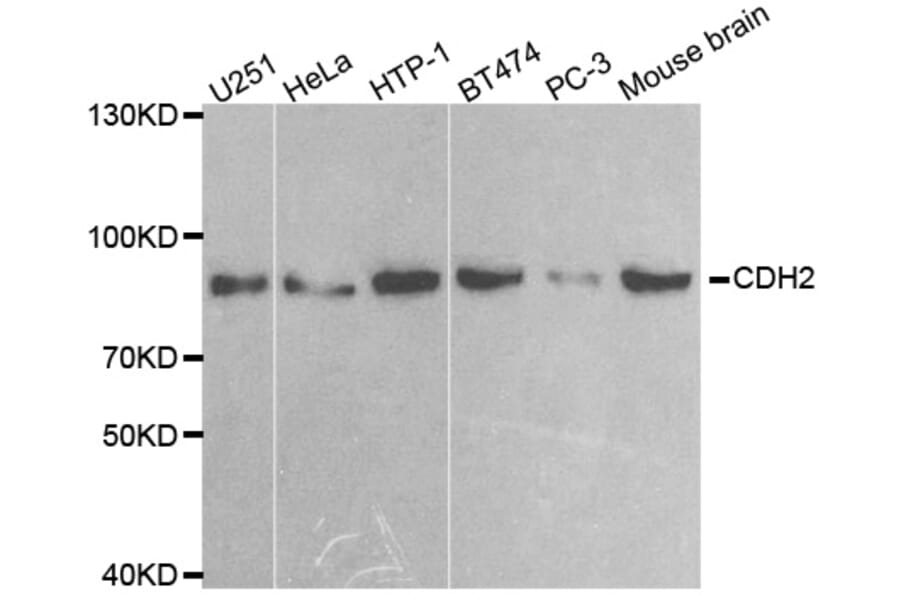 Western blot - CDH2 antibody from Signalway Antibody (38551) - Antibodies.com