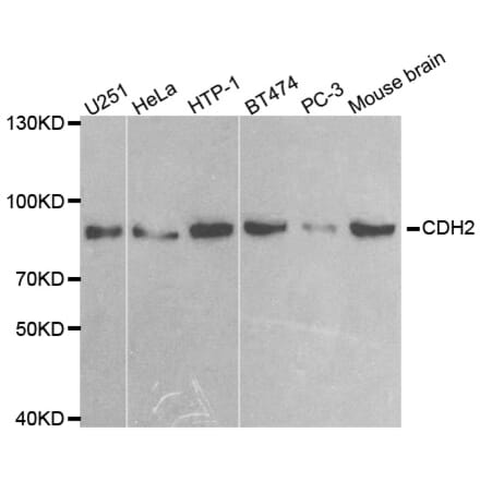 Western blot - CDH2 antibody from Signalway Antibody (38551) - Antibodies.com