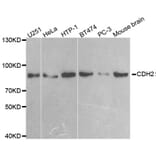 Western blot - CDH2 antibody from Signalway Antibody (38551) - Antibodies.com