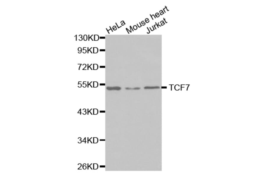 Western blot - TCF7 antibody from Signalway Antibody (38572) - Antibodies.com