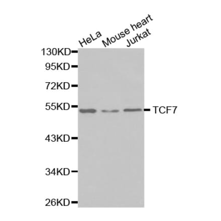 Western blot - TCF7 antibody from Signalway Antibody (38572) - Antibodies.com