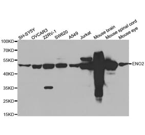 Western blot - ENO2 antibody from Signalway Antibody (38589) - Antibodies.com