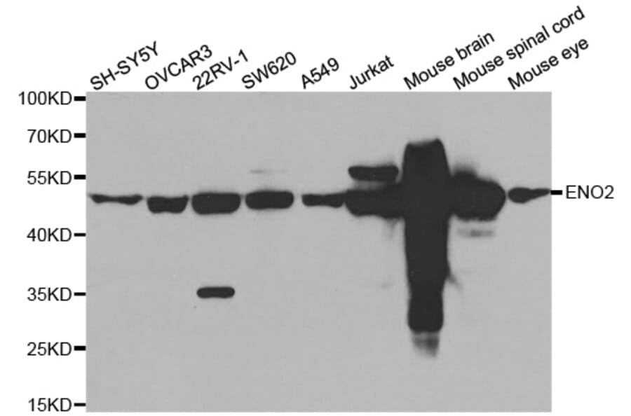 Western blot - ENO2 antibody from Signalway Antibody (38589) - Antibodies.com