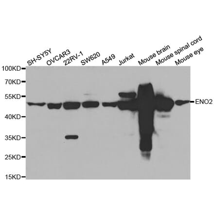 Western blot - ENO2 antibody from Signalway Antibody (38589) - Antibodies.com