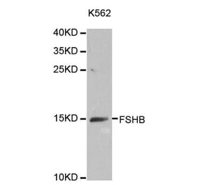 Western blot - FSHB antibody from Signalway Antibody (38642) - Antibodies.com