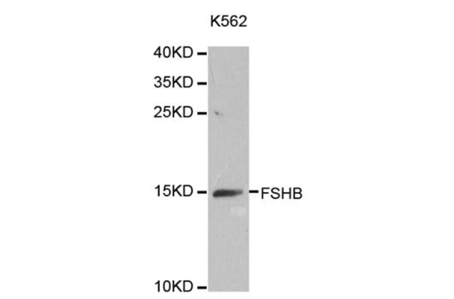 Western blot - FSHB antibody from Signalway Antibody (38642) - Antibodies.com