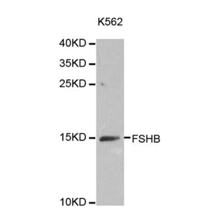 Western blot - FSHB antibody from Signalway Antibody (38642) - Antibodies.com