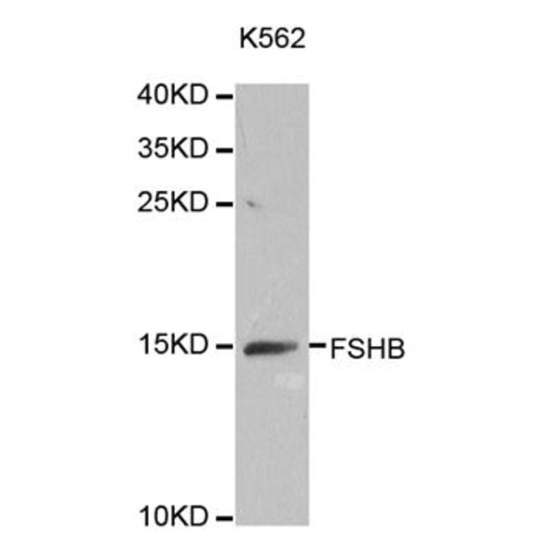 Western blot - FSHB antibody from Signalway Antibody (38642) - Antibodies.com