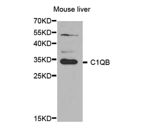 Western blot - C1QB antibody from Signalway Antibody (38644) - Antibodies.com