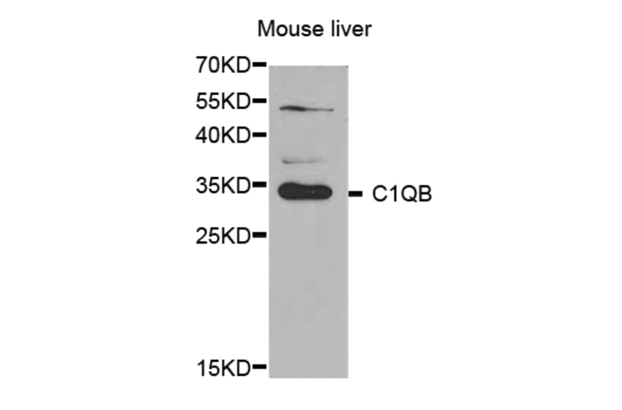 Western blot - C1QB antibody from Signalway Antibody (38644) - Antibodies.com
