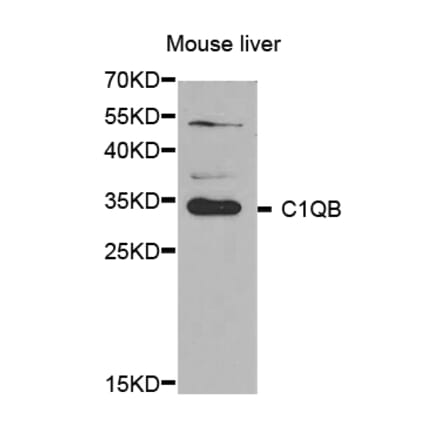 Western blot - C1QB antibody from Signalway Antibody (38644) - Antibodies.com