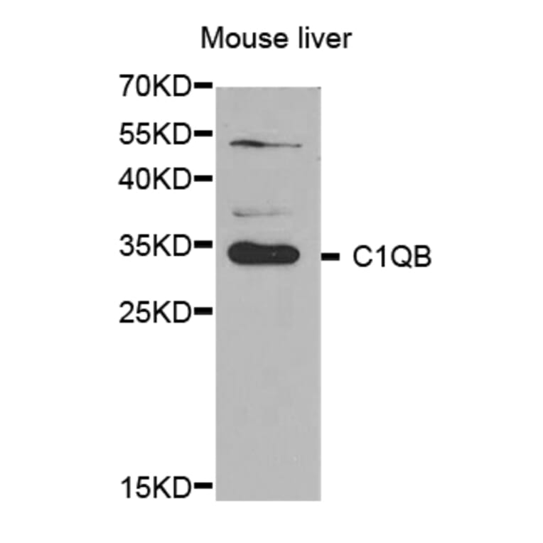 Western blot - C1QB antibody from Signalway Antibody (38644) - Antibodies.com
